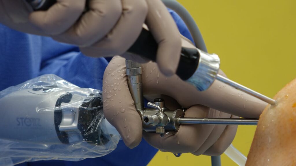 Hip Arthroscopy Surgery in Baner
