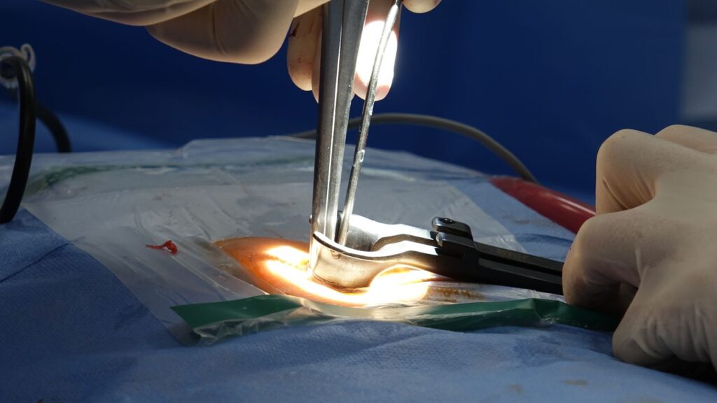 Meniscus Repair Surgery in Baner