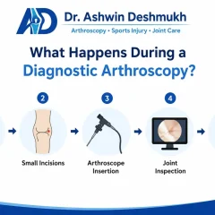What Happens During a Diagnostic Arthroscopy? Complete Guide