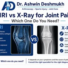 MRI vs X-Ray for Joint Pain: Which One Do You Need?