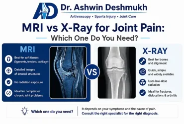 MRI vs X-ray for joint pain
