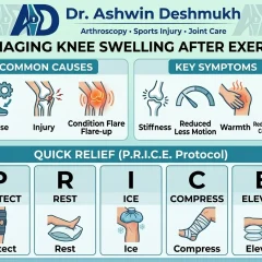 Knee Swelling After Exercise: Causes and Quick Relief