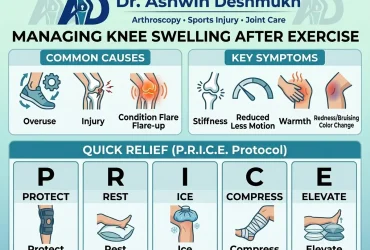 knee swelling after exercise